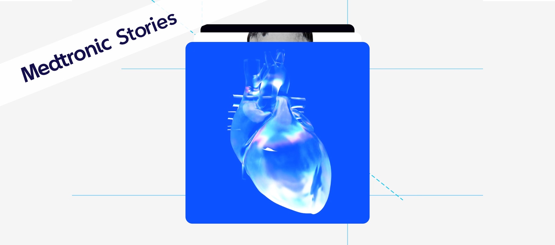 Stylized illustration of an anatomical heart